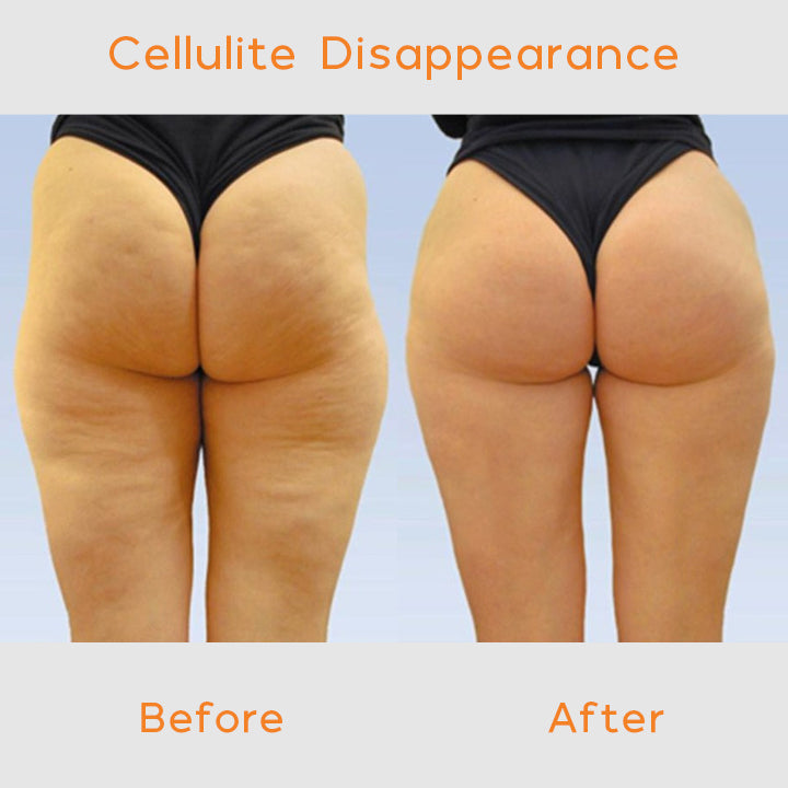 EMS Hip Massage Enhancer