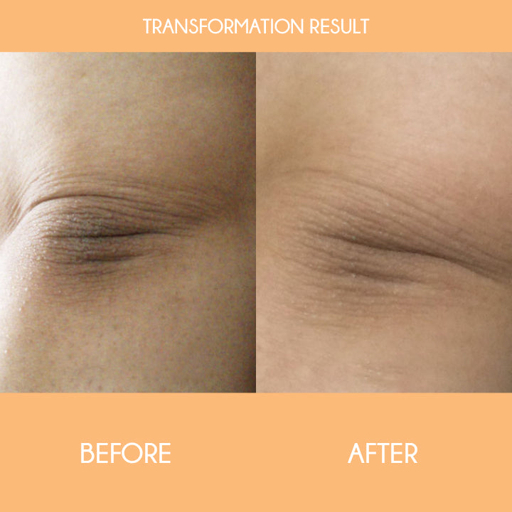 SkinRevive™ Orange Peeling Lotion