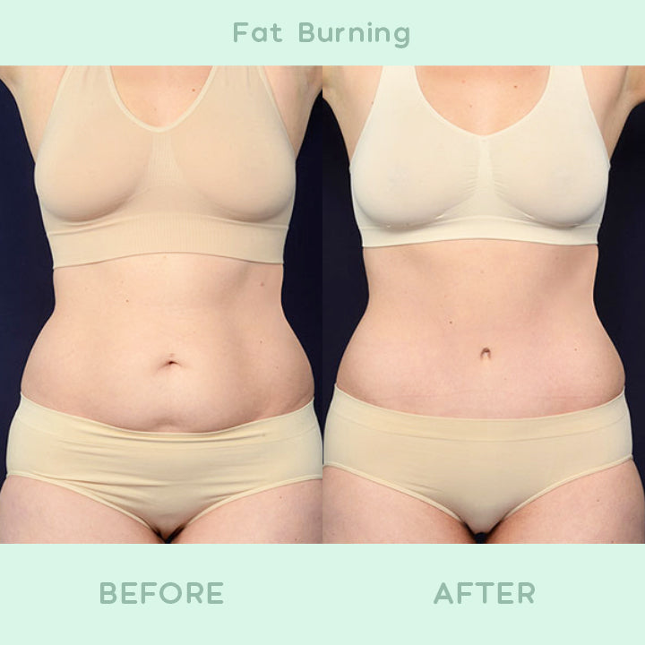 FirmSkin™ Tightening & Slimming Gel