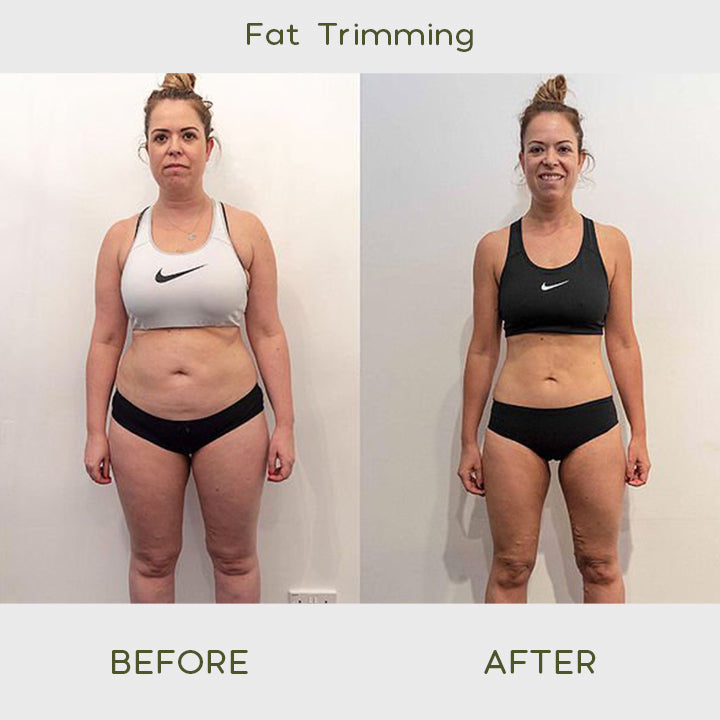 BellyBURN™ Waist Slimming Patch