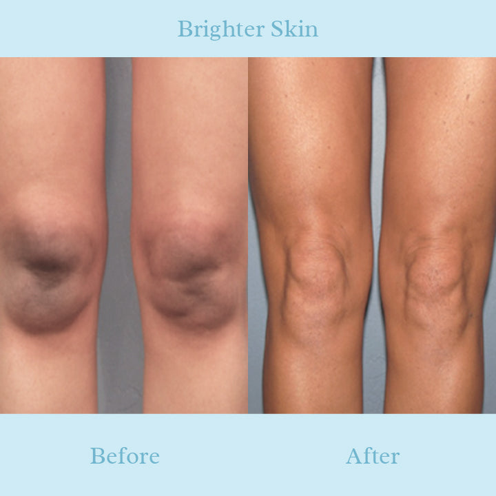 Glowy™ Brightening Body Cream