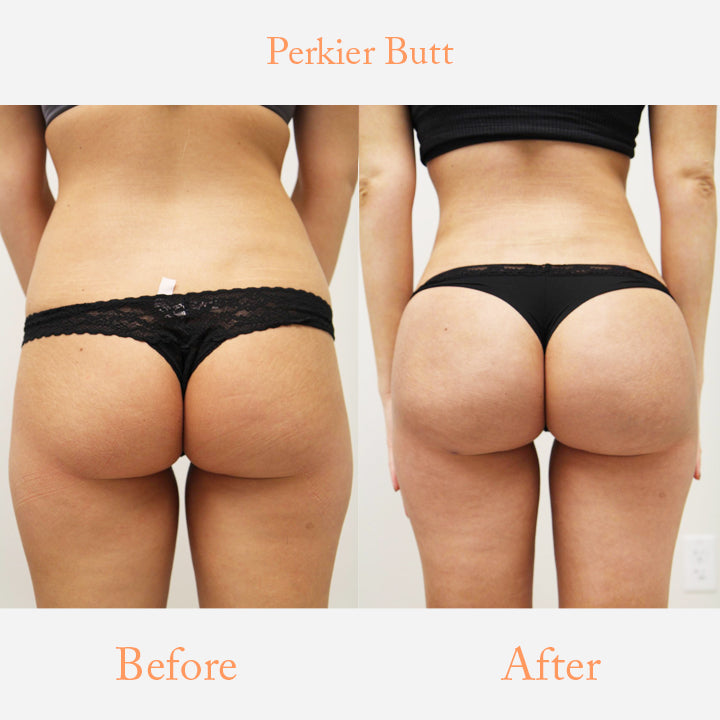 PlumpOrigin Buttlock Enhancement Collagen Soap