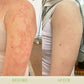 TineaCure™ Antifungal Cream