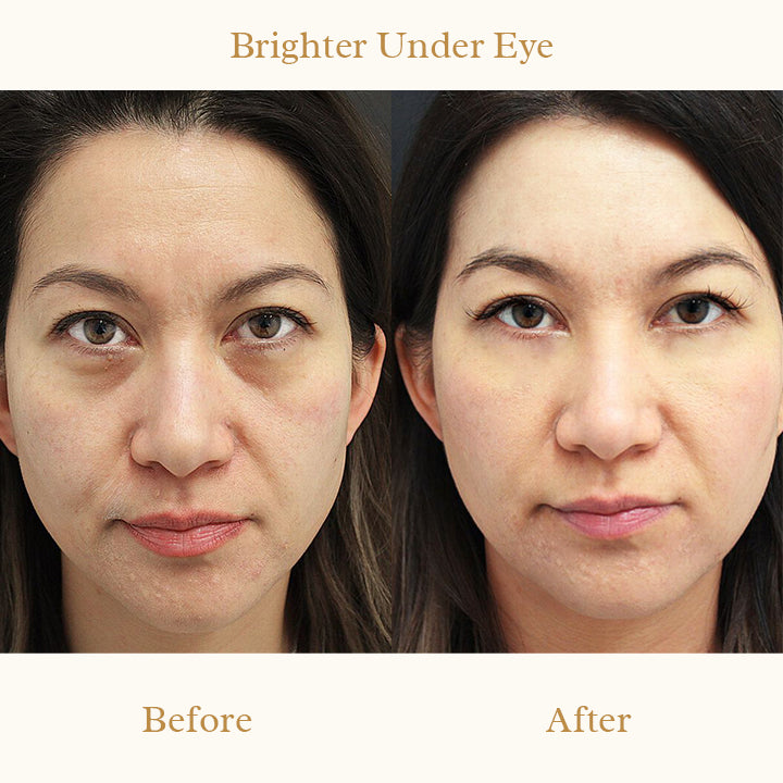 Derm+ Peptide Eye Cream Pro