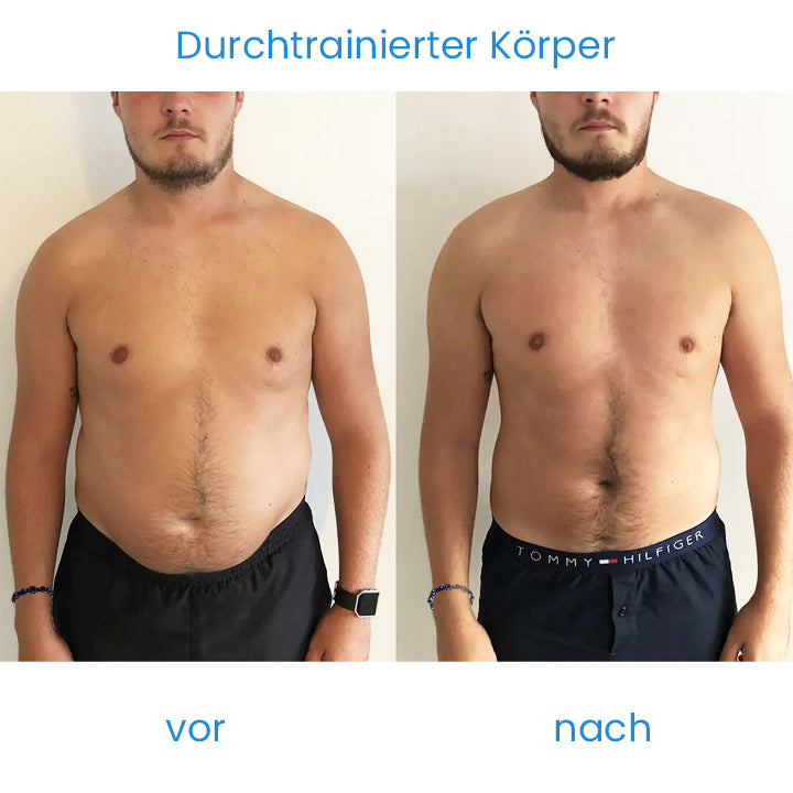 MOZAKA SlimFit ThermoTherapie-Armband