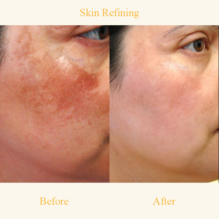 CLEARITY™ Clarifying Serum