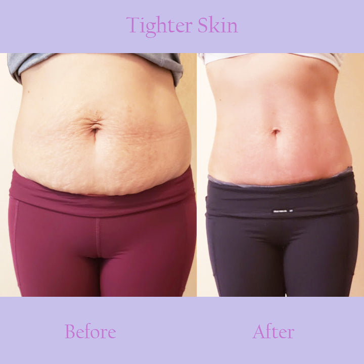 CelluBurn™ Slimming Soap
