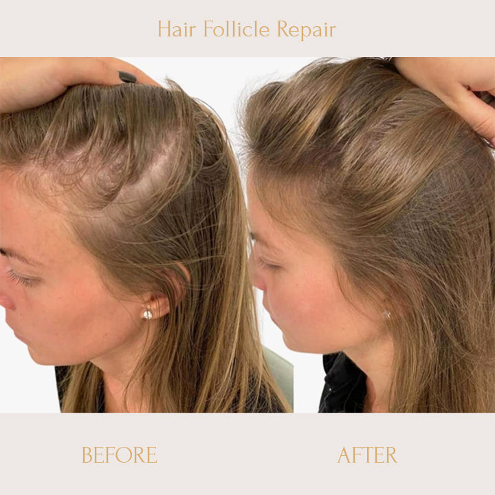 RegrowPlus™ Rice Water Serum