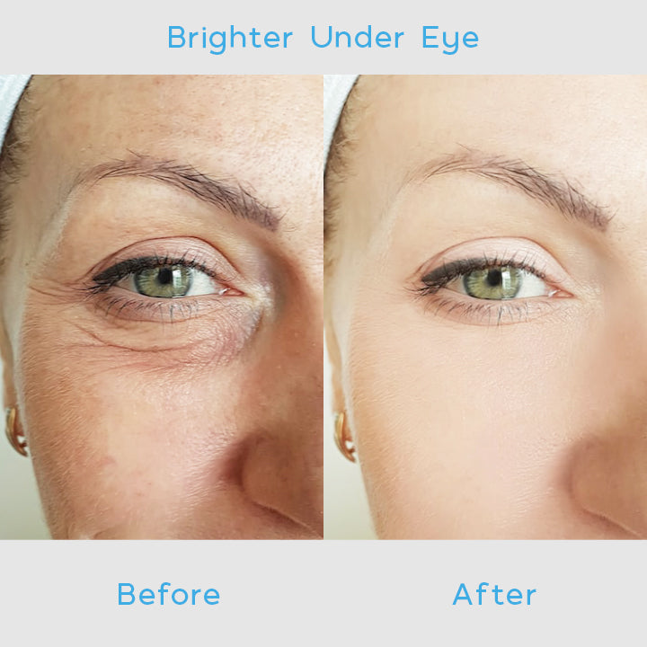 DERMBRIGHT™ Anti-Wrinkle Eye Cream Pro