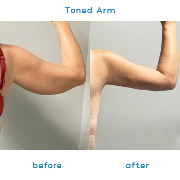 Vigor+™ Thermochromic Lymph Detox Bracelet