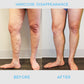 VeinDefense™ Varicose Treatment Spray
