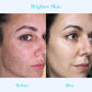 SKINPURE™ Dark Spot Corrector Cream