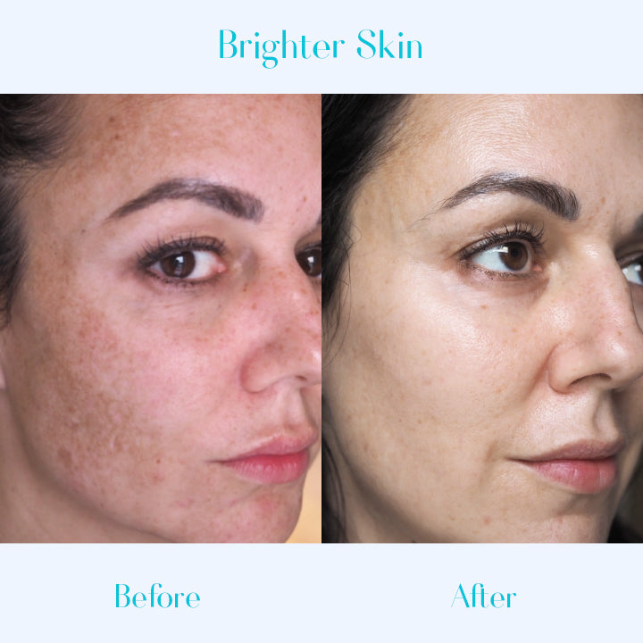SKINPURE™ Dark Spot Corrector Cream
