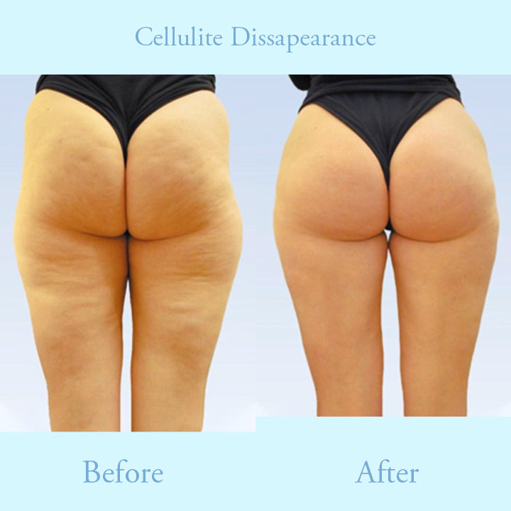 ProFirm Skin Tightening Spray