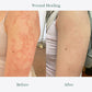 FungiCure™ Anti-Fungal Spray