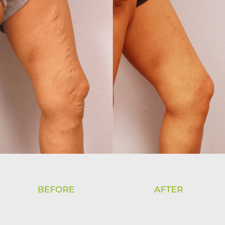 HerbPro™ Detoxifying Foot Pads