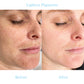 Nlurad™ Dark Spot And Acne Treatment Lotion