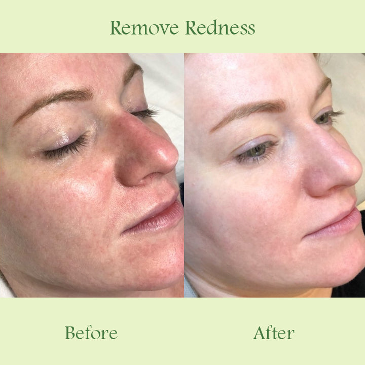 Skinnery™ Pore Cleansing Mask