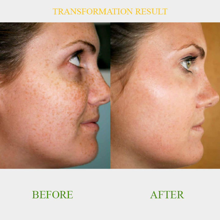 ClearSkin™ Brightening Serum