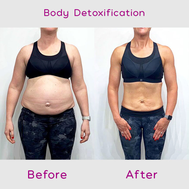 BurnUp Belly Shaping Patches
