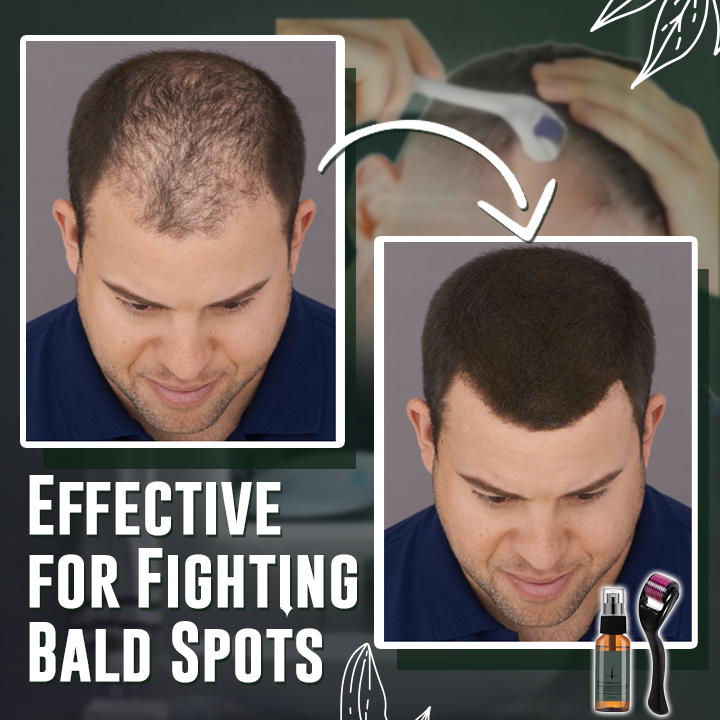 Natural Beard Growth Roller Kit