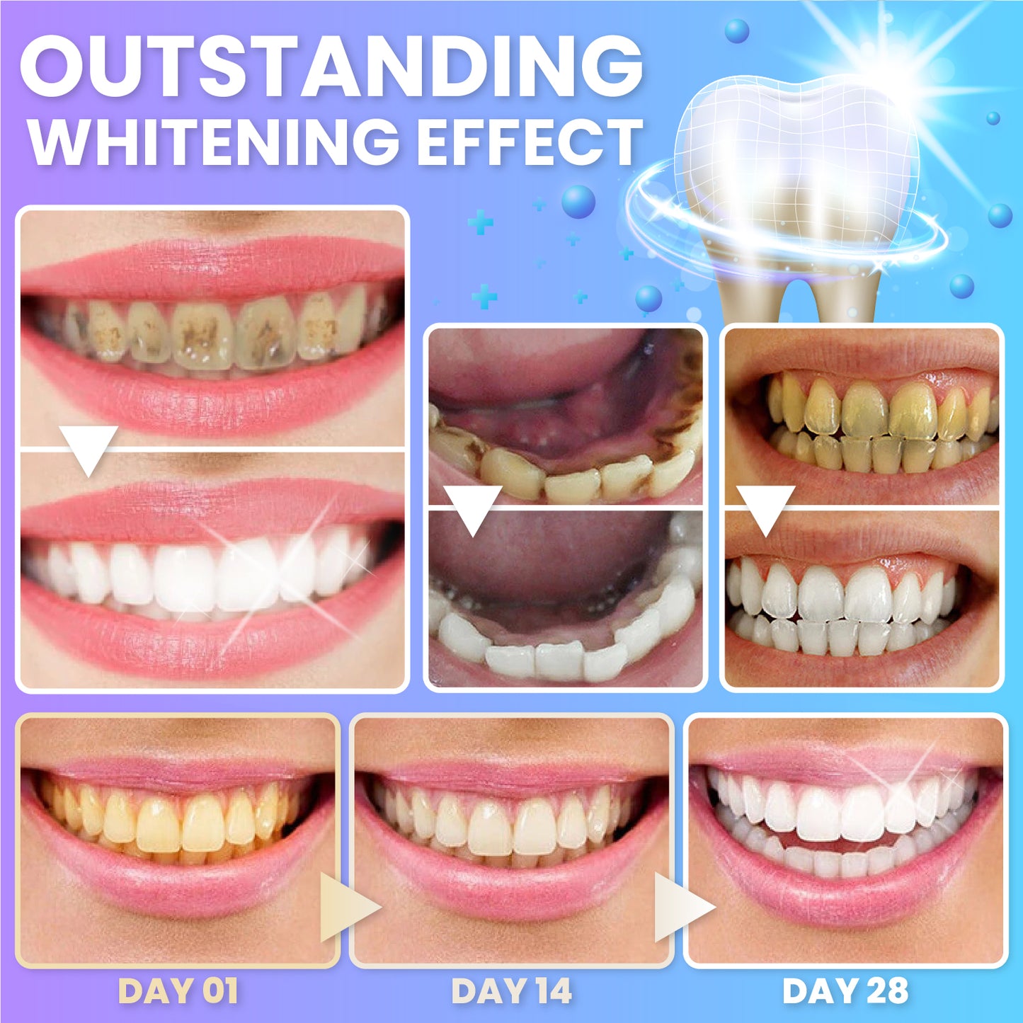 BrighTeeth™ Instant Whitening Foam Toothpaste