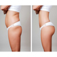 Butt Lifting Shaping Patch