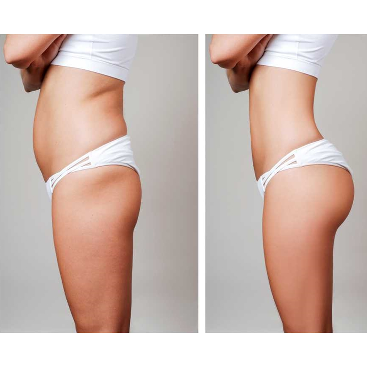 Butt Lifting Shaping Patch