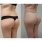 Butt Lifting Shaping Patch