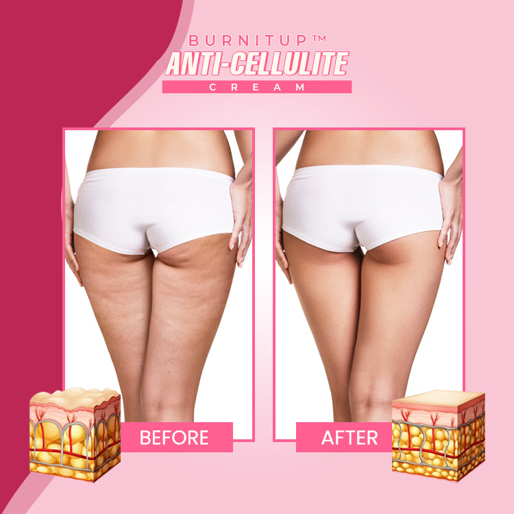 BurnItUp™ Caffeine Slimming Cream