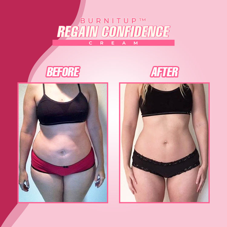 BurnItUp™ Caffeine Slimming Cream