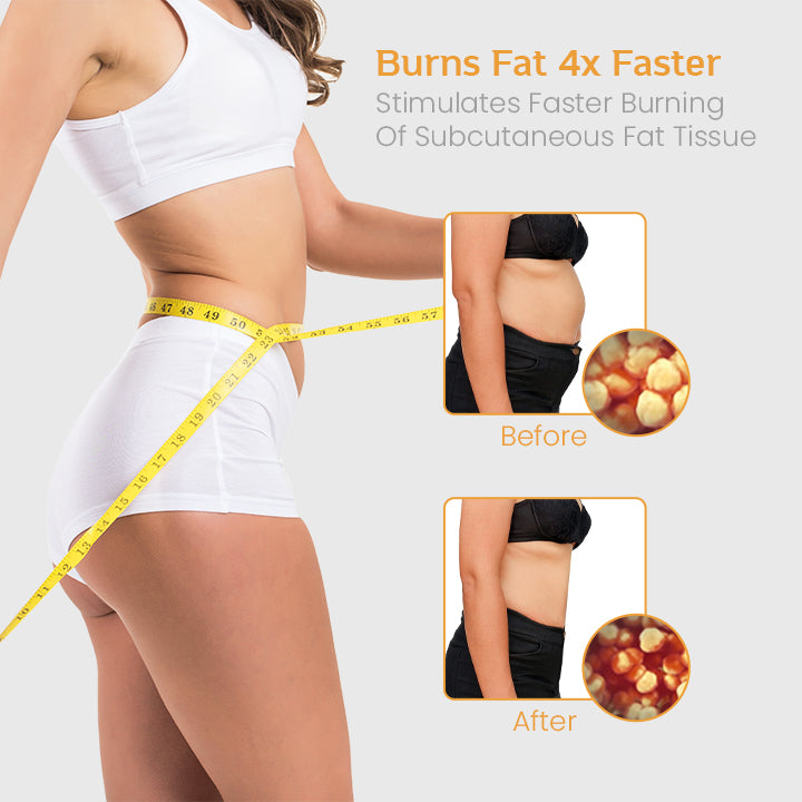 FitBod™ Anti-Cellulite Slimming Spray