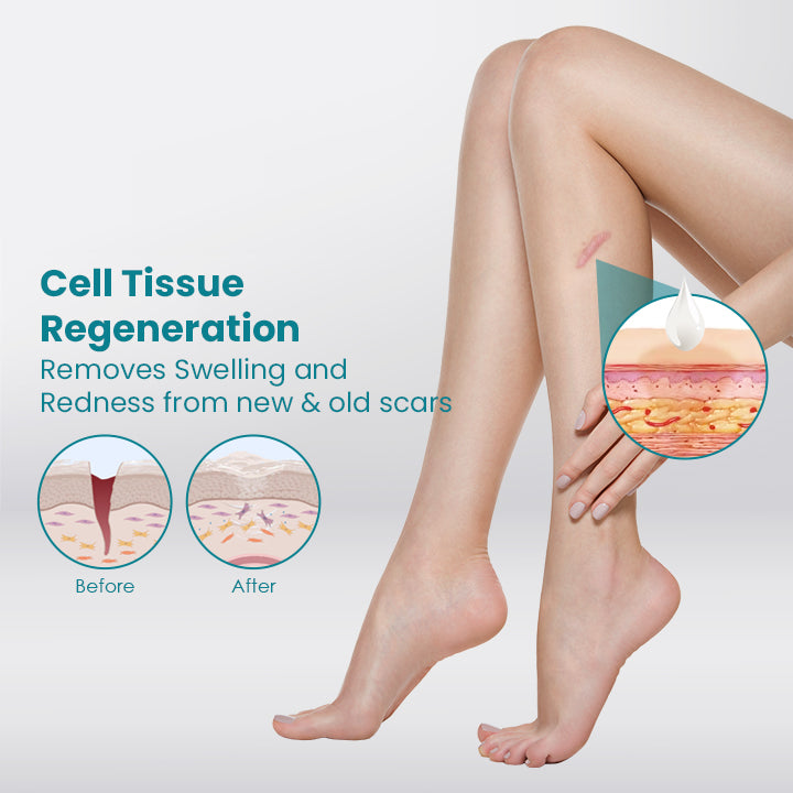 ScarOFF™ Advanced Scar Removal Gel