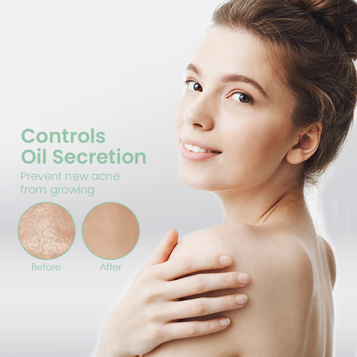 CLEARBAC™ Back Acne Treatment Spray