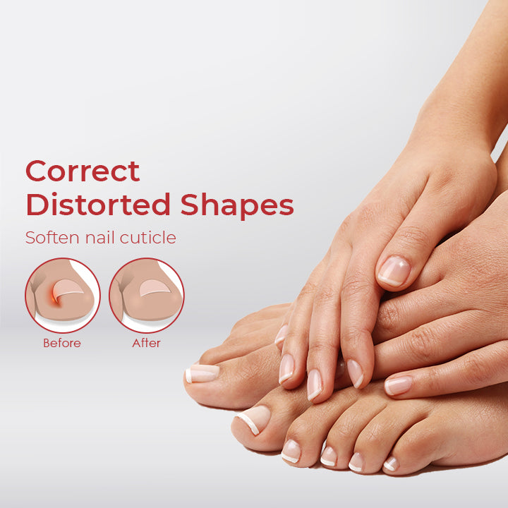 NailPro™ Anti Paronychia Relief Oil