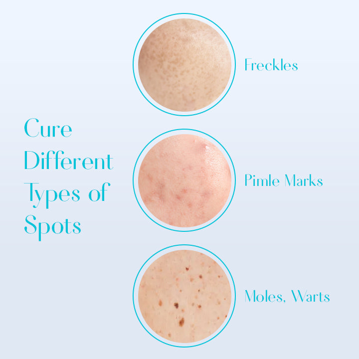 SKINPURE™ Dark Spot Corrector Cream