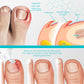 NailRevive™ Psoriasis Recovery Gel