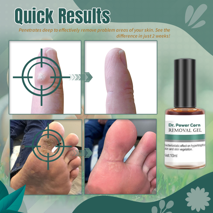 Dr. Power Corn Removal Gel