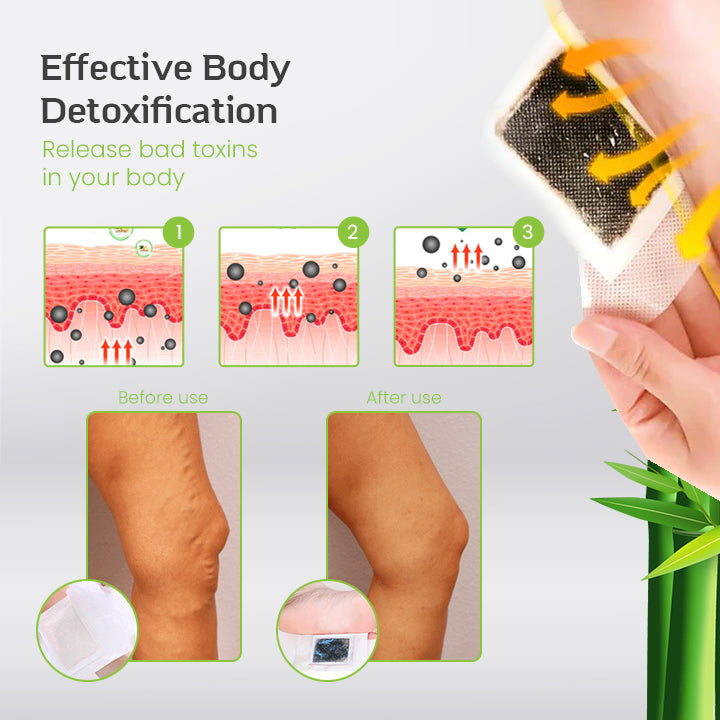 VaricoseVeinRx™ Herbal Foot Patch
