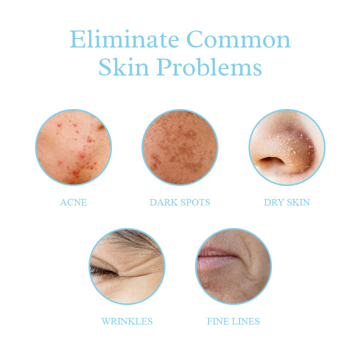 Nlurad™ Dark Spot And Acne Treatment Lotion