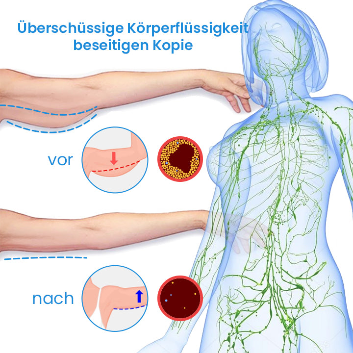 MOZAKA SlimFit ThermoTherapie-Armband