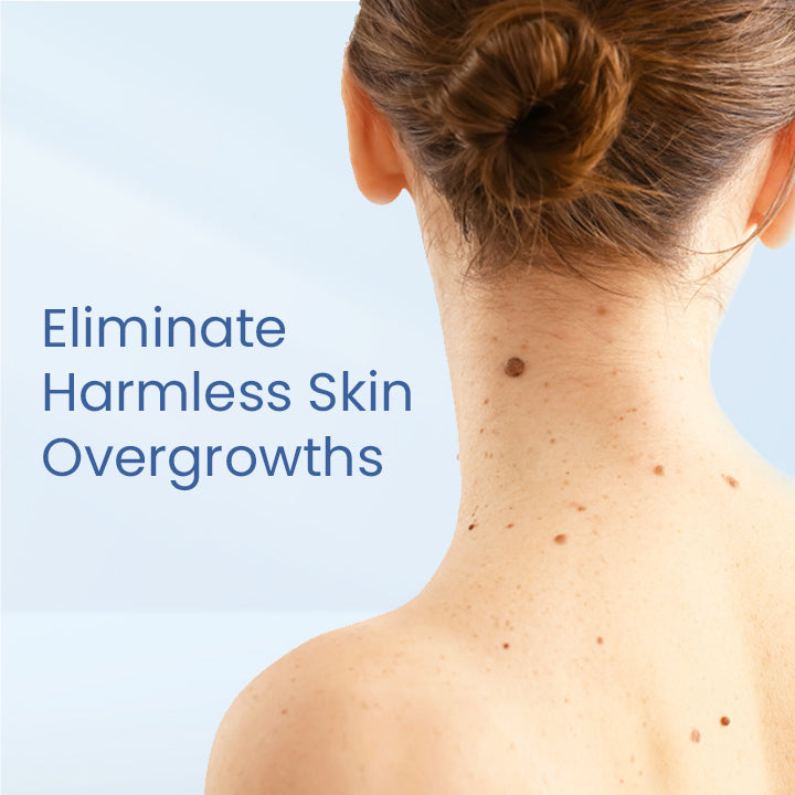 Skin Tag Remover Patch