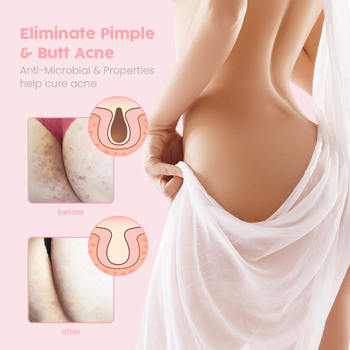 BumBliss™ Booty Perfect Exfoliating Soap
