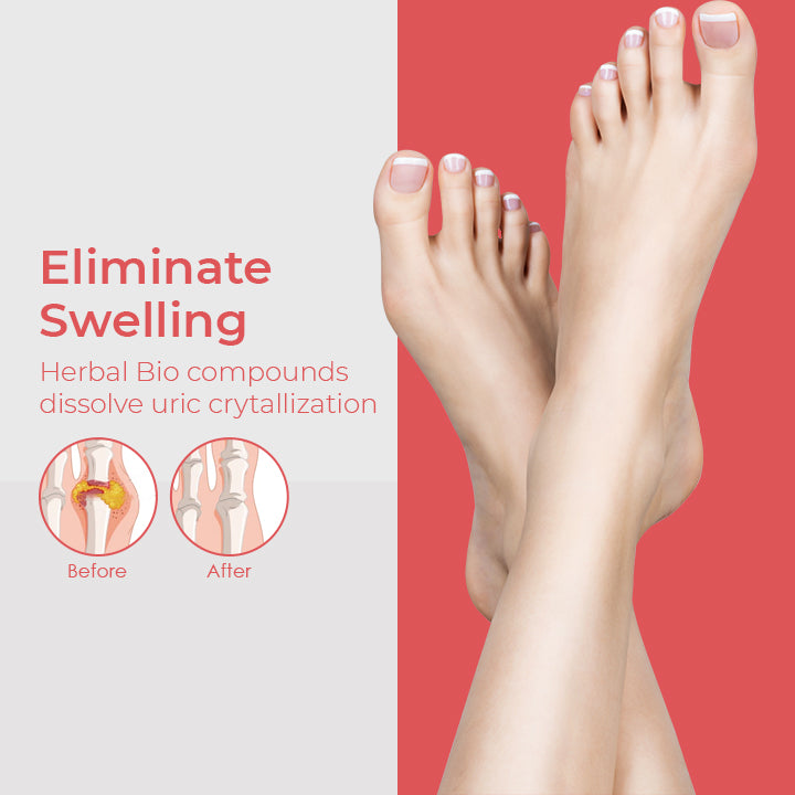 UriGone™ Healing Ointment for Gout