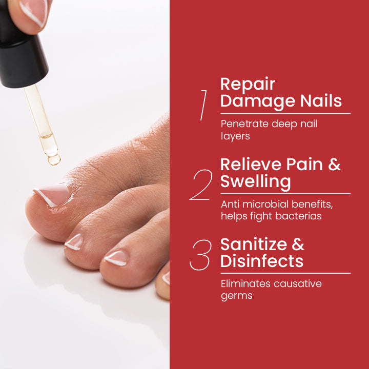NailPro™ Anti Paronychia Relief Oil