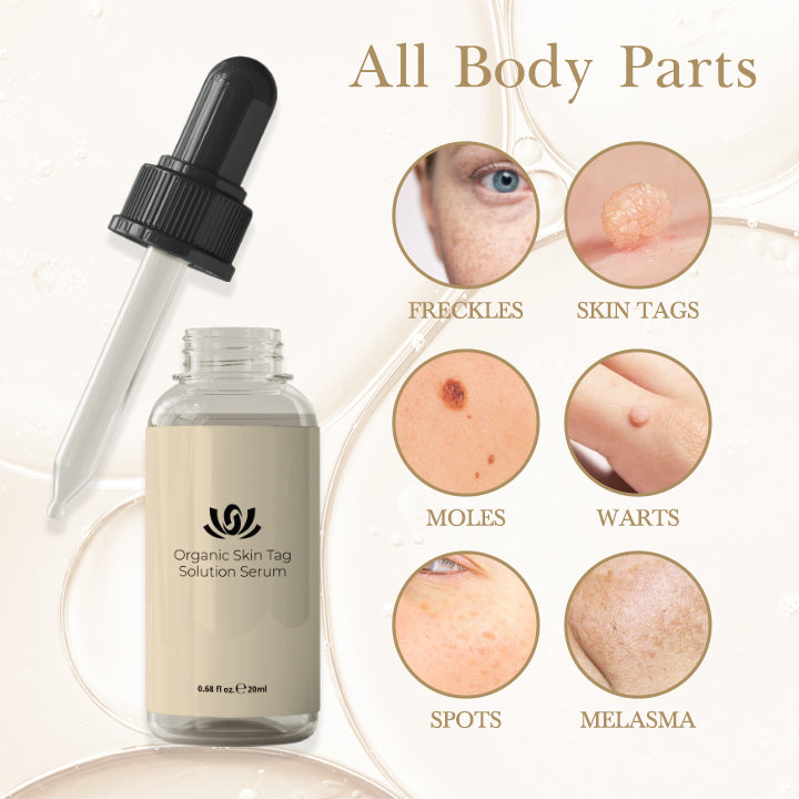 SkinRenew™ Spot Refining Serum