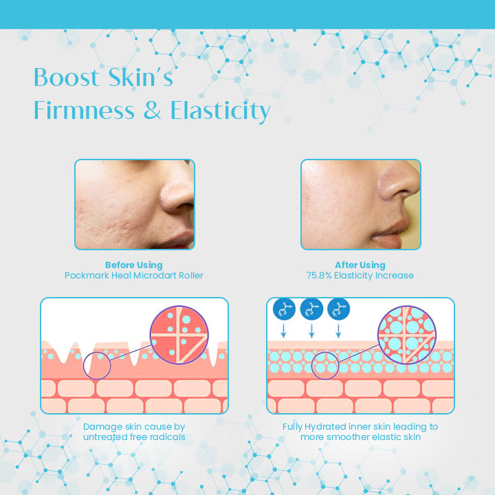 HyaluFix ™ Pockmark Heal Microdart Roller