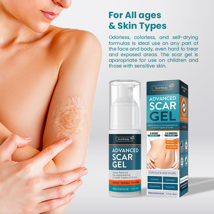ScarOFF™ Advanced Scar Removal Gel