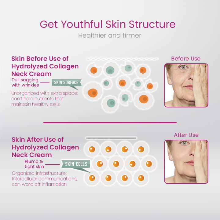 CollagenLUXE™ Hydrolyzed Collagen Neck Cream