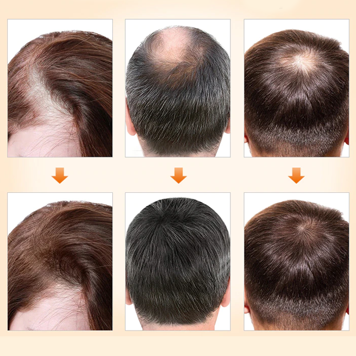 Ginger Hair Regrowth Shampoo Bar